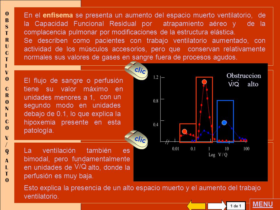 Relación v / q hipertensión pulmonar